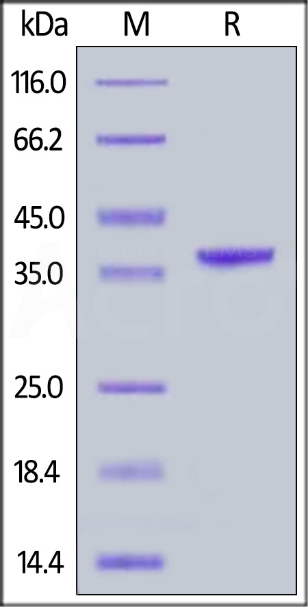Human Arginase 1, His Tag (Cat. No. AR1-H5228) SDS-PAGE gel