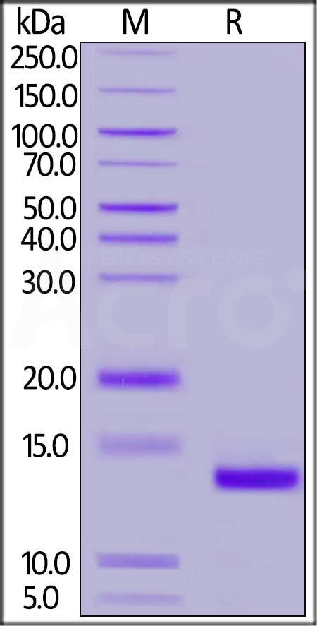 Cynomolgus / Rhesus macaque B2M, His Tag (Cat. No. B2M-C5226) SDS-PAGE gel
