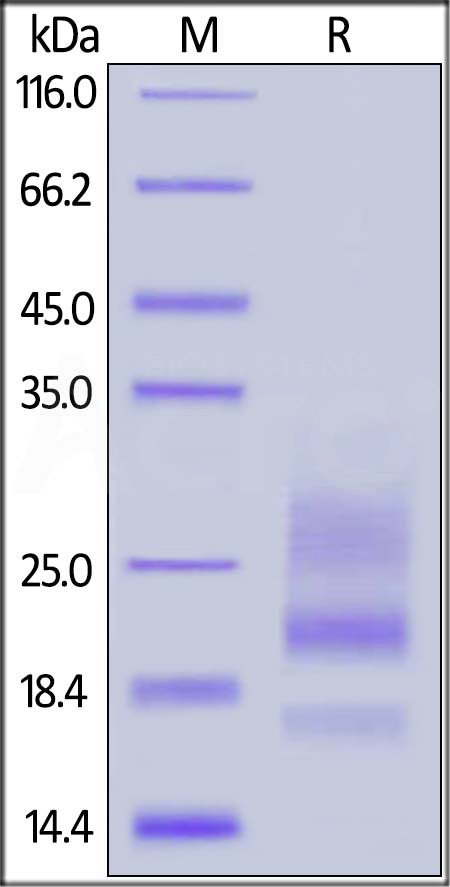 Human CD83, His Tag (Cat. No. CD3-H5223) SDS-PAGE gel