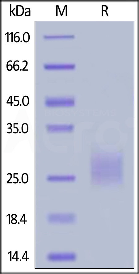 Human CD94, His Tag (Cat. No. CD4-H52H8) SDS-PAGE gel
