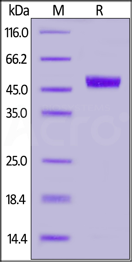 Human CD5, His Tag (Cat. No. CD5-H52H5) SDS-PAGE gel