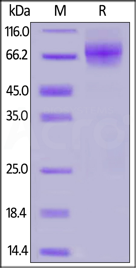 Human CD6, His Tag (Cat. No. CD6-H52H7) SDS-PAGE gel