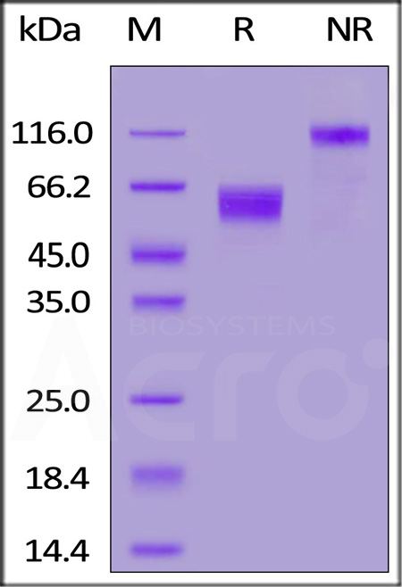 Rat CD47, Fc Tag (Cat. No. CD7-R5256) SDS-PAGE gel
