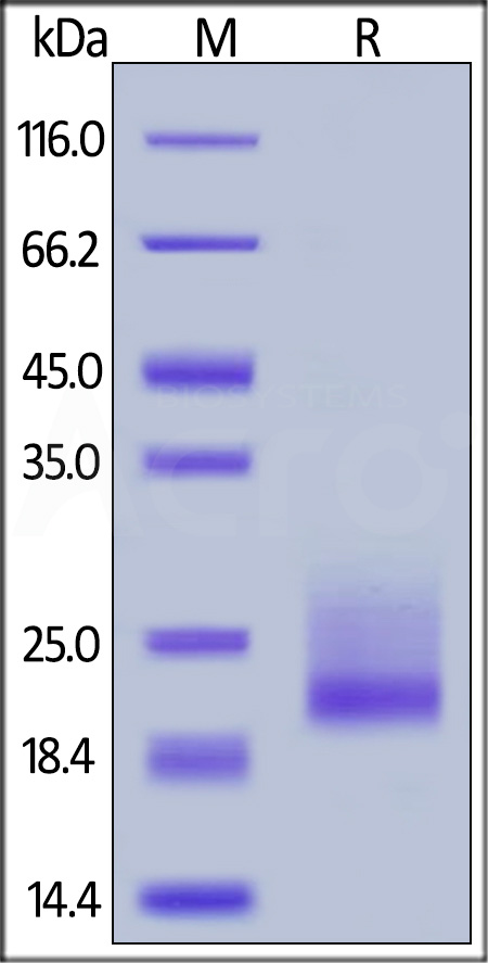 Human CD69, His Tag (Cat. No. CD9-H5222) SDS-PAGE gel
