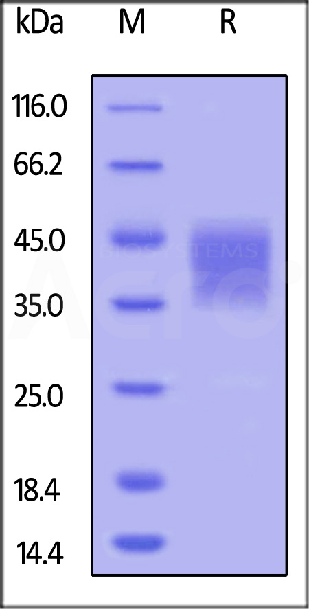 Human CD16b (NA1), His Tag (Cat. No. CDB-H5227) SDS-PAGE gel
