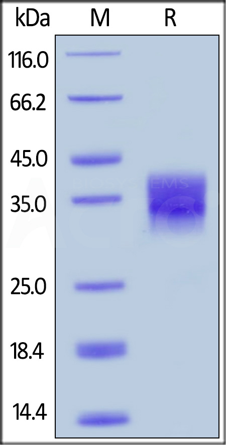 Mouse CD32b, His Tag (Cat. No. CDB-M52H7) SDS-PAGE gel