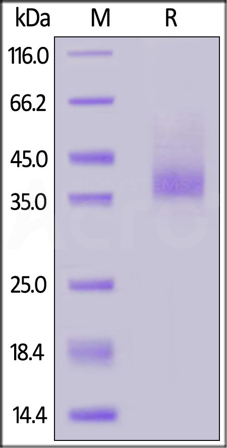 Human CXCR4, Fc Tag (Cat. No. CX4-H5269) SDS-PAGE gel