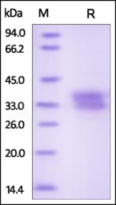 Human Ephrin-B1, His Tag (Cat. No. EF1-H5223) SDS-PAGE gel