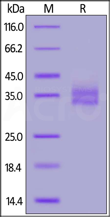 Rhesus macaque EpCAM, His Tag (Cat. No. EPM-C5227) SDS-PAGE gel