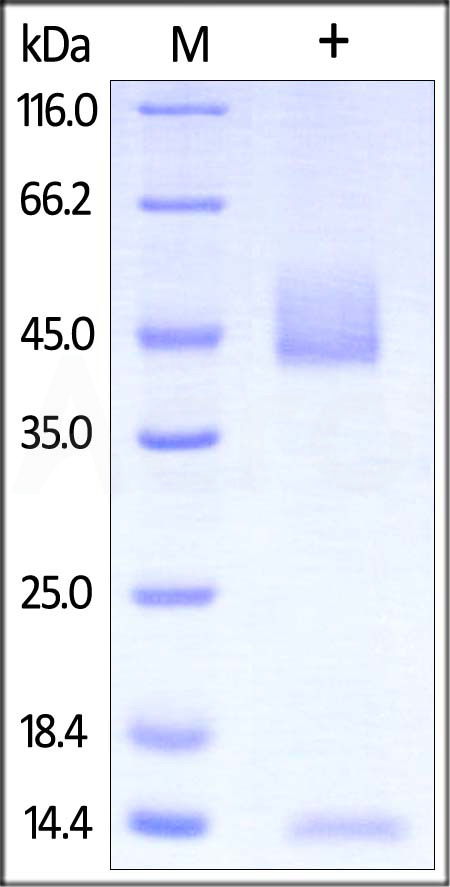 Rat FCGRT&B2M Heterodimer Protein, His Tag&Strep II Tag (Cat. No. FCM-R5287) SDS-PAGE gel