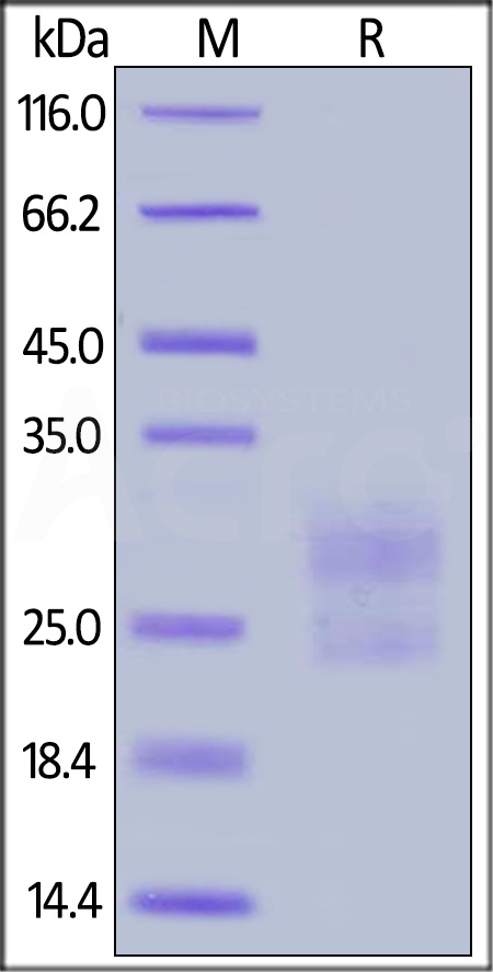 Mouse ICOS (C137S, C138S) Protein, His Tag (Cat. No. ICS-M52H8) SDS-PAGE gel