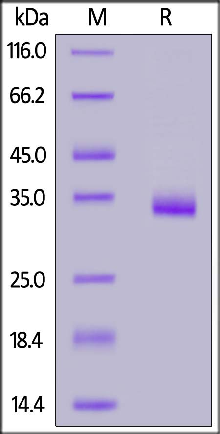 Human IGFBP-7, His Tag (Cat. No. IG7-H5240) SDS-PAGE gel