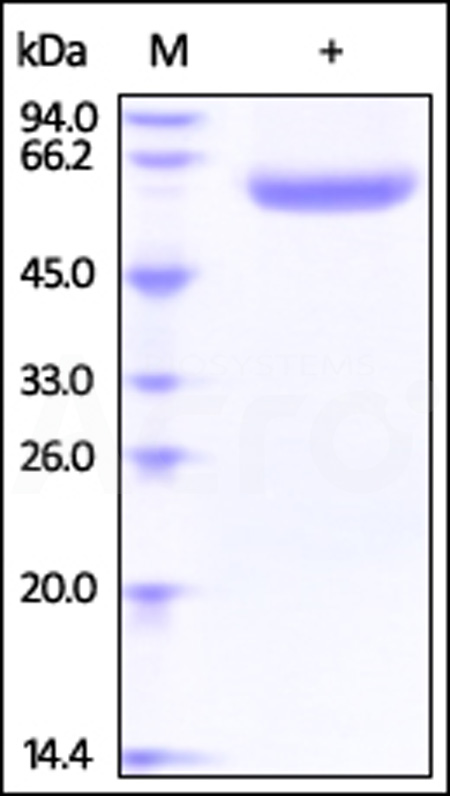 Human Lipopolysaccharide, His Tag (Cat. No. LBP-H52H5) SDS-PAGE gel