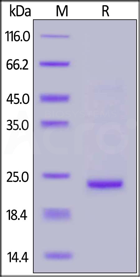 SARS-CoV-2 NSP8, His Tag (Cat. No. NS8-C5149) SDS-PAGE gel
