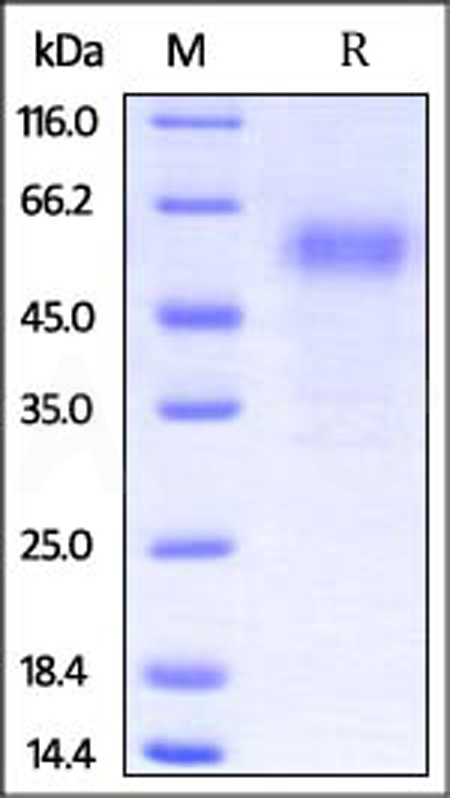 Rabbit PD-1, Fc Tag (Cat. No. PD1-RB5251) SDS-PAGE gel