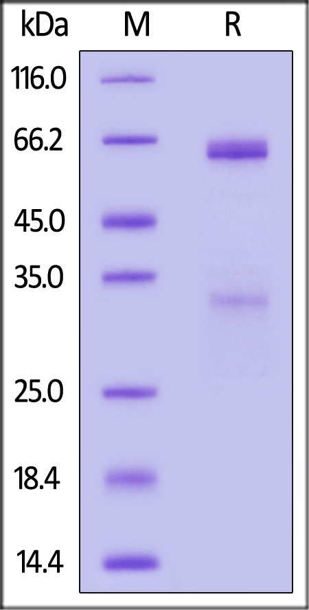 Human R-Spondin 3 Protein, Fc Tag (Cat. No. RS3-H5253) SDS-PAGE gel