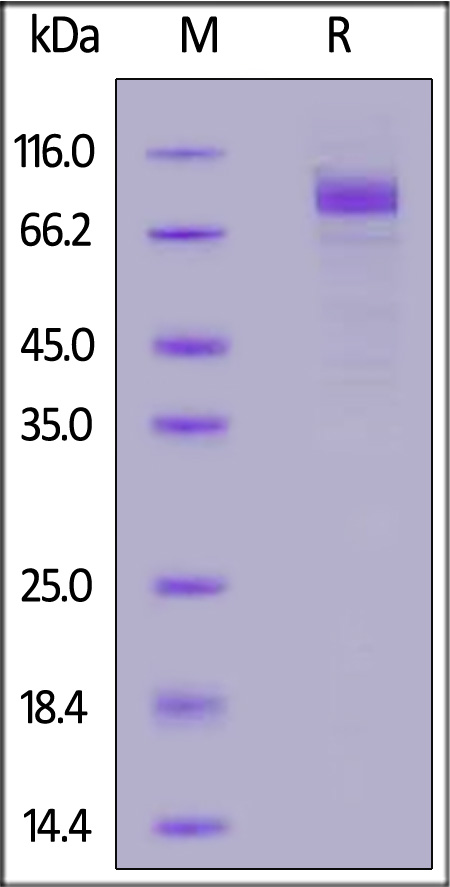 Human SCARB1, Fc Tag (Cat. No. SC1-H5258) SDS-PAGE gel