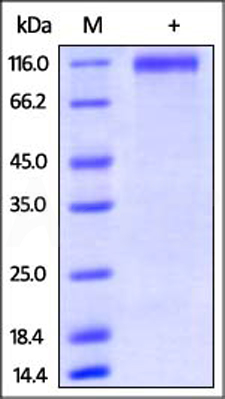 Human P-Selectin, His Tag (Cat. No. SEP-H52E4) SDS-PAGE gel