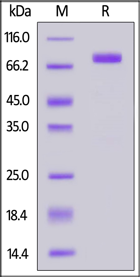 Human SIRP beta, Fc Tag (Cat. No. SIA-H5257) SDS-PAGE gel