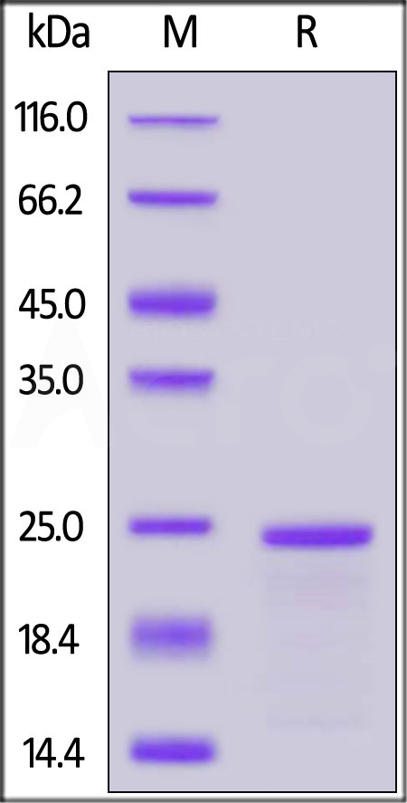 Human SLC1A5, His Tag, TrxA Tag (Cat. No. SL5-H5149) SDS-PAGE gel