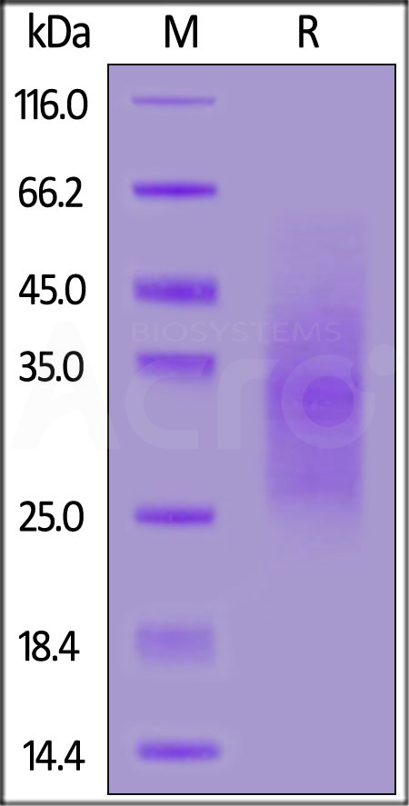 Human TGF-beta RII, His Tag (Cat. No. TG2-H52H5) SDS-PAGE gel