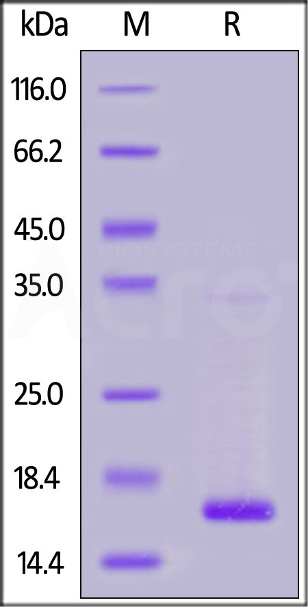 Human Transthyretin, His Tag (Cat. No. TTR-H5223) SDS-PAGE gel