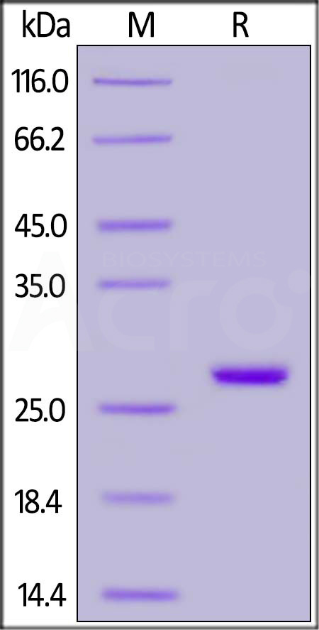 Human UCH-L1, His Tag (Cat. No. UC1-H5140) SDS-PAGE gel