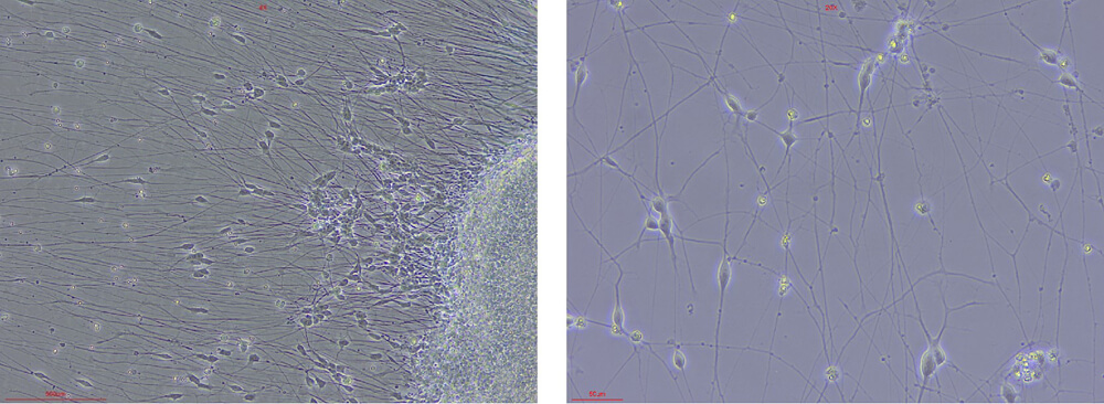 BDNF STEM CELL CULTURE