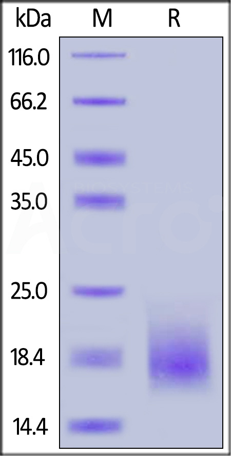 Human Activin RIB, His Tag (Cat. No. ACB-H52H4) SDS-PAGE gel