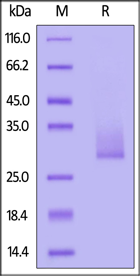 Human Angiopoietin-like 3, His Tag (Cat. No. AN3-H5226) SDS-PAGE gel