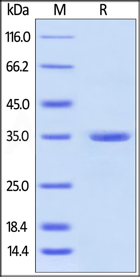 Human Annexin A5, His Tag (Cat. No. AN5-H5123) SDS-PAGE gel