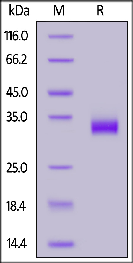 Human ANGPTL7, His Tag (Cat. No. AN7-H52H5) SDS-PAGE gel