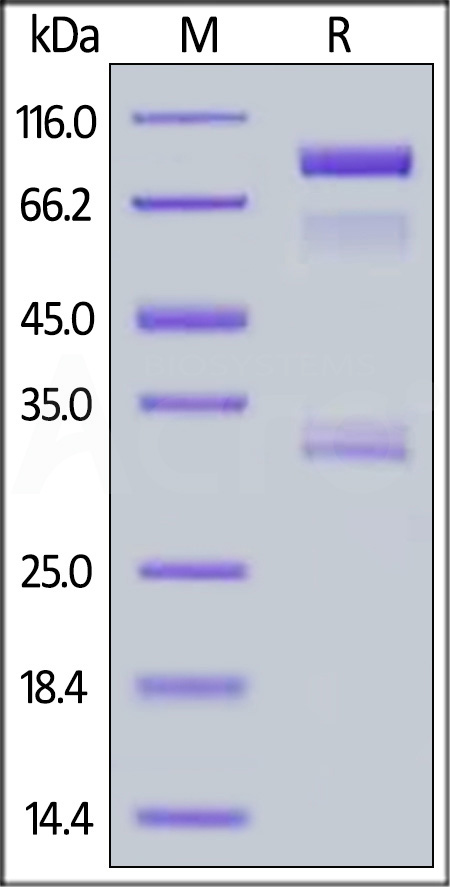 Human BACE-1, Fc Tag (Cat. No. BA1-H5261) SDS-PAGE gel