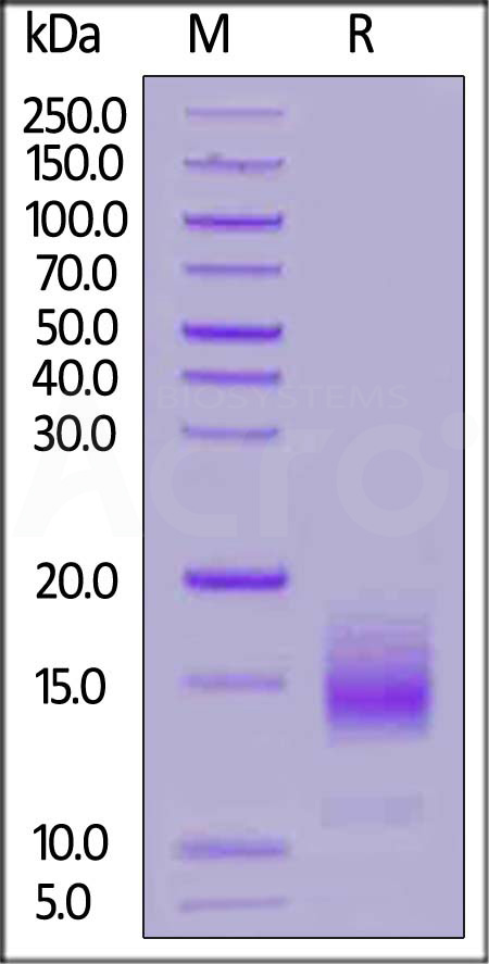 Human BCMA Protein, His Tag (HPLC-verified) (Cat. No. BCA-H522y) SDS-PAGE gel