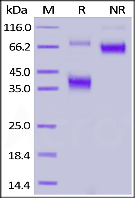 FITC-Labeled Human BCMA Protein, Fc Tag (Cat. No. BCA-HF254) SDS-PAGE gel