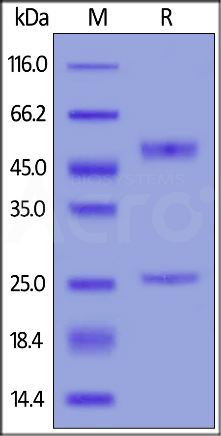 Anti-Bevacizumab Antibodies (recommended for ADA assay) (Cat. No. BEB-Y9) SDS-PAGE gel