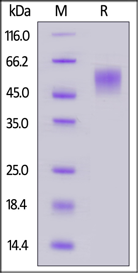 Ebolavirus (subtype Bundibugyo, strain Uganda 2007) GP1, His Tag (Cat. No. BEP-V5221) SDS-PAGE gel