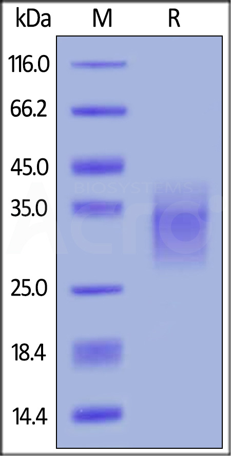 Biotinylated Human BTLA (31-150), His,Avitag (Cat. No. BTA-H82E6) SDS-PAGE gel