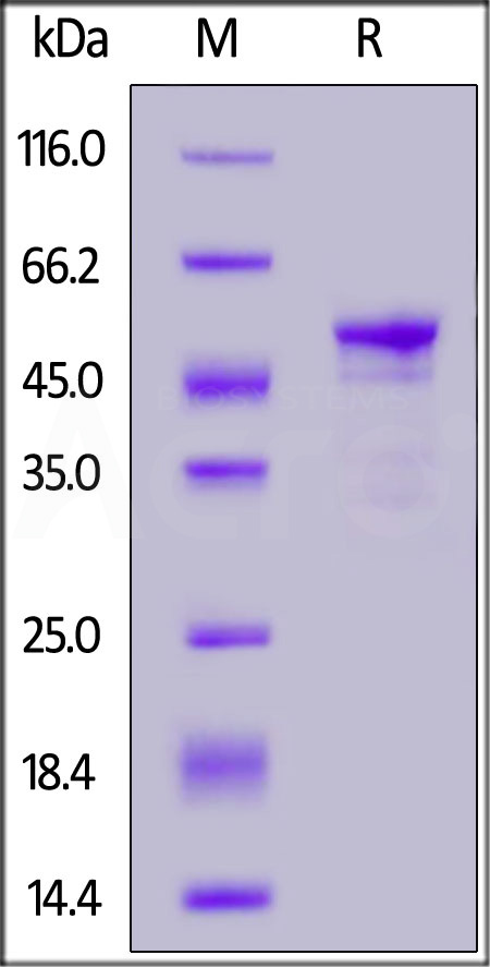 Human Carbonic Anhydrase IX (38-414), His Tag (Cat. No. CA9-H5226) SDS-PAGE gel