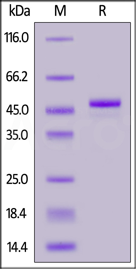 Mouse Carbonic Anhydrase IX (32-390), His Tag (Cat. No. CA9-M52H3) SDS-PAGE gel