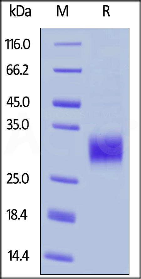 Human CD32a (H167), His Tag (Cat. No. CD1-H5223) SDS-PAGE gel