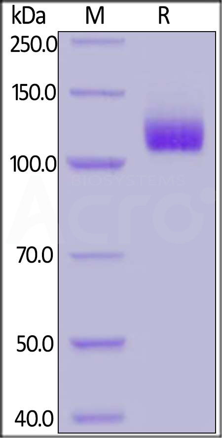 Human CD31, Fc Tag (Cat. No. CD1-H5258) SDS-PAGE gel