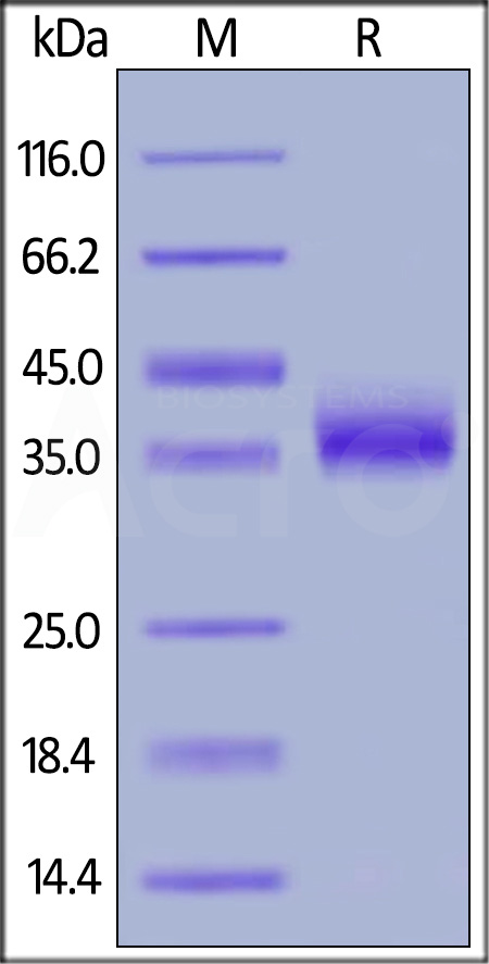 Human IL-2 R beta, His Tag (SPR verified) (Cat. No. CD2-H5221) SDS-PAGE gel