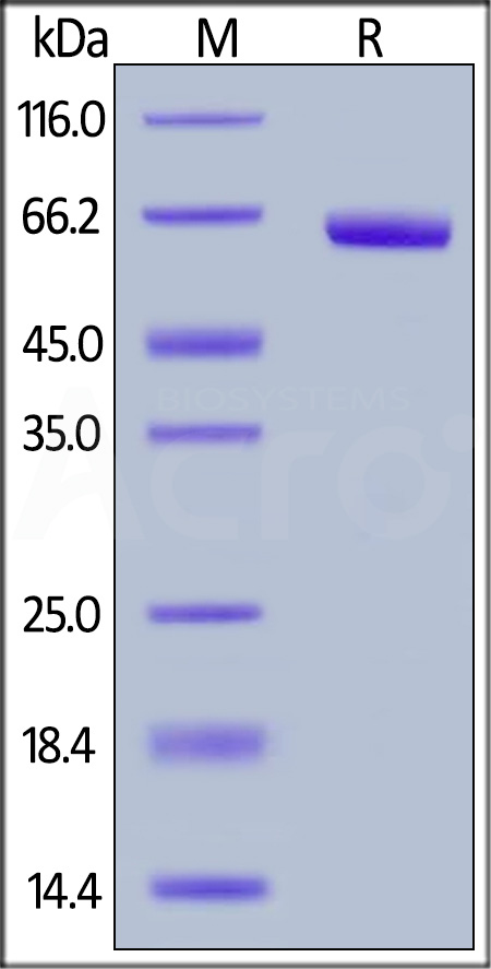 Human CD72, Fc Tag (Cat. No. CD2-H5251) SDS-PAGE gel