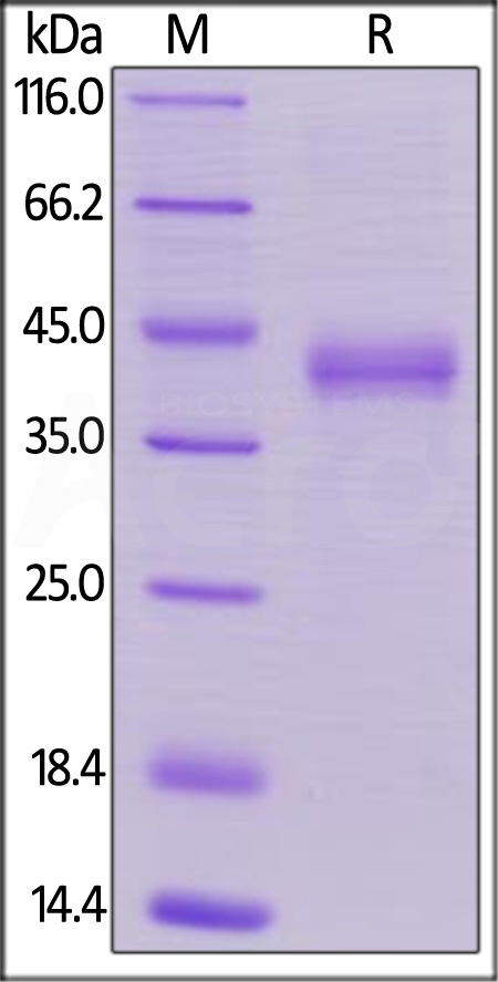 Human CD23, His Tag (Cat. No. CD3-H5249) SDS-PAGE gel