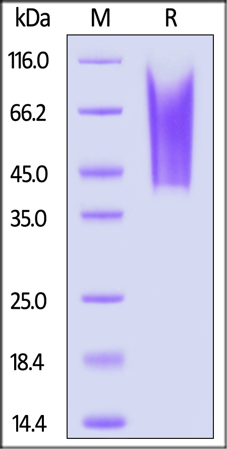 Human CD43, His Tag (Cat. No. CD3-H52H9) SDS-PAGE gel
