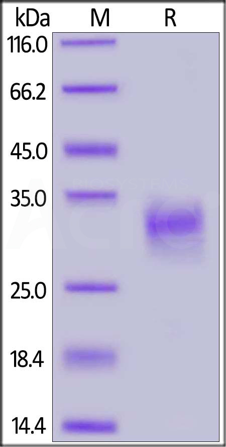 Human CD74, His Tag (Cat. No. CD4-H524c) SDS-PAGE gel