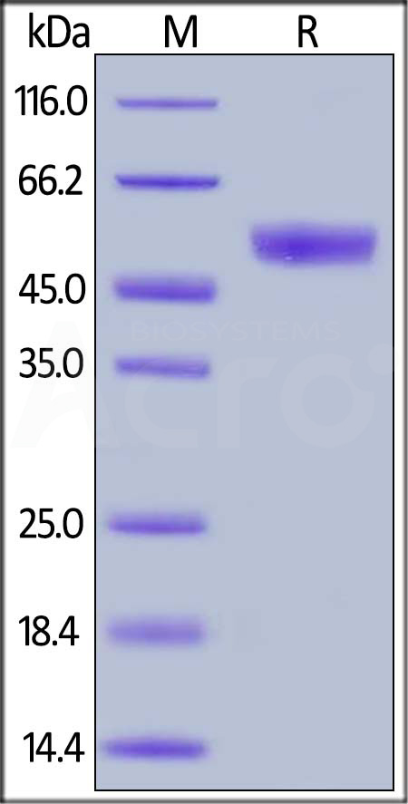Human CD94, Mouse IgG2a Fc Tag (Cat. No. CD4-H5253) SDS-PAGE gel