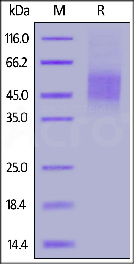 Human CD46, His Tag (Cat. No. CD6-H5226) SDS-PAGE gel