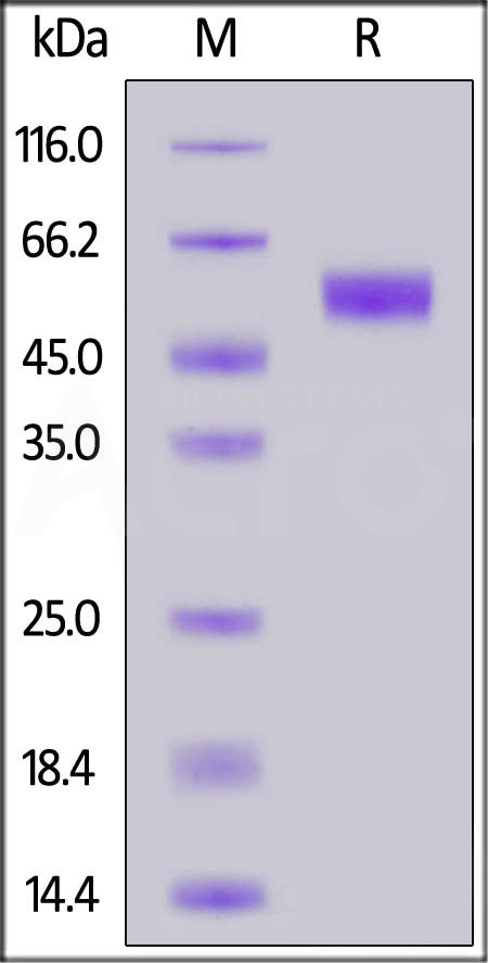 Human CD37, Fc Tag (Cat. No. CD7-H525a) SDS-PAGE gel